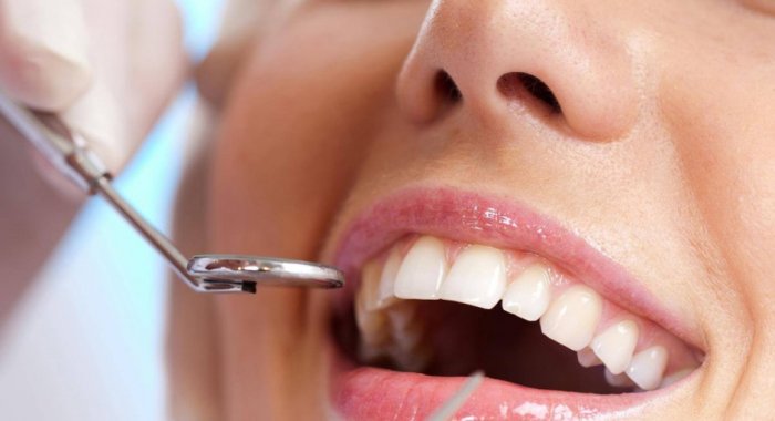 Как лечили зубы до появления анестезии