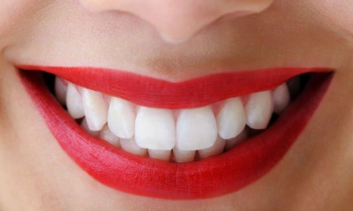 Отбеливание зубов у стоматолога особенности