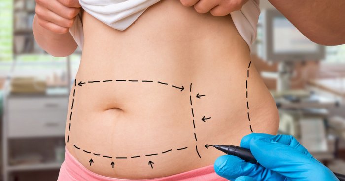 Contourslim