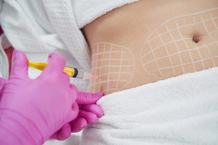 Contourslim vs. Другие липолитики
