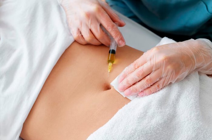 Contourslim